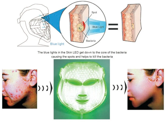 Europe ver hot selling CE 7 Color skin care pdt mask/led light photon therapy led pdt mask