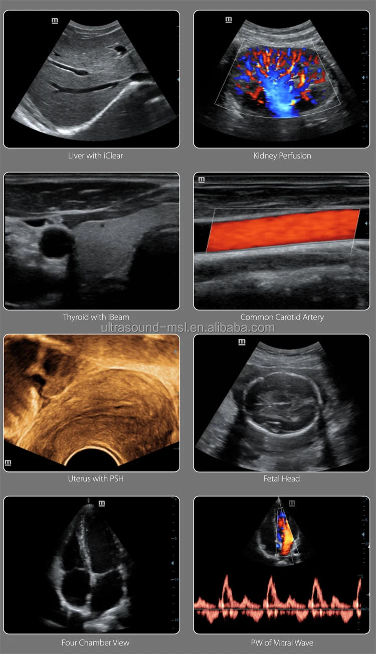 完美价格迈瑞4d彩色多普勒超声,超声机器心脏超声
