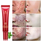 MEIYANQIONG Acne Scar Removal Cream Skin Repair Stretch Marks Whitening Cream