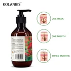 wholesale organic mild herbal biotin hair growth shampoo private label for hair loss people effective