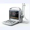 Factory price hospital clinics equipment Ultrasonic Machine portable Ultrasound Scanner