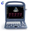 /product-detail/vet-portable-ultrasound-scanner-animal-veterinary-portable-color-doppler-ultrasound-machine-sonoscape-s2v-60210695755.html