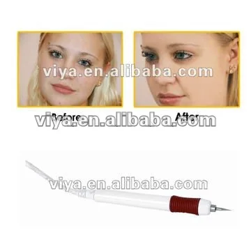 spot removal