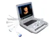 4D software handle ultrasound scanner