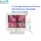 Class II Camera Dental 15 Inch LCD Screen CCD High Definition WiFi Dental Intraoral Camera