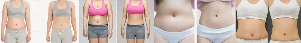 weight loss slimming Other Beauty Equipment