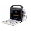 OB/GYN CE approved portable color doppler ultrasound for hospital and clinic