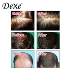 Hair Regrowth Product Herbal Hair Regrowth Product Herbal Hair Regrowth Product