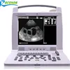 /product-detail/12-inch-lcd-veterinary-portable-ultrasound-scanner-96-element-probes-for-vet-pregnancy-bo-vb02-60695842744.html