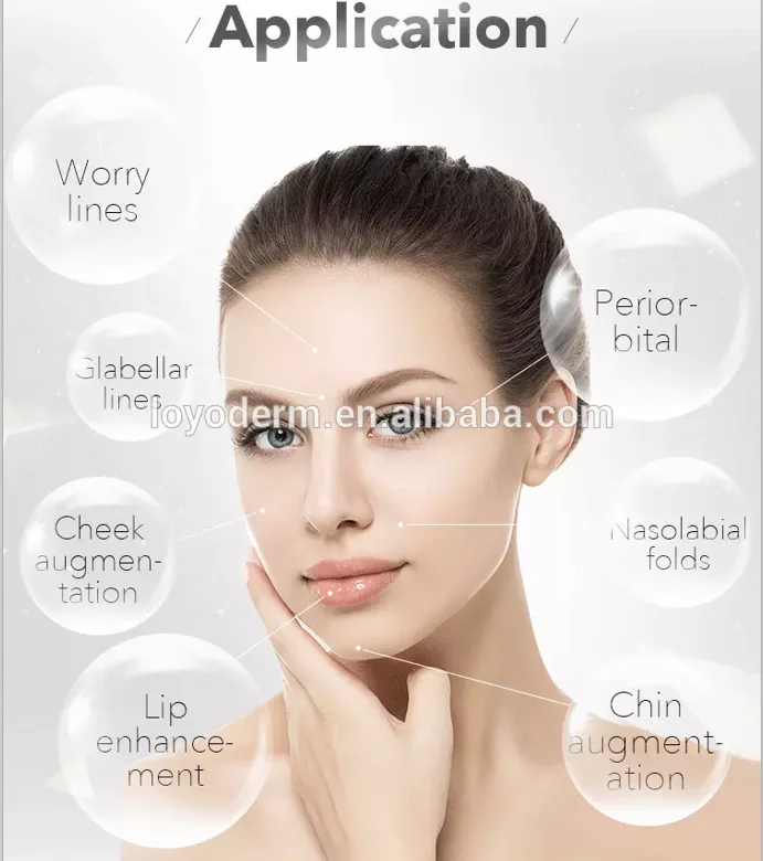 is a series of cross-linked hyaluronic acid dermal fillers that