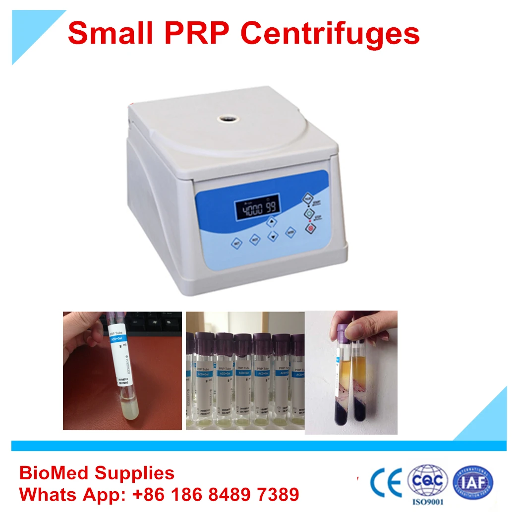 tube centrifugal separator prp centrifuge