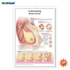Licensed Educational Plastic 3D Medical Anatomical Wall Chart /Poster - Understanding Breast Cancer