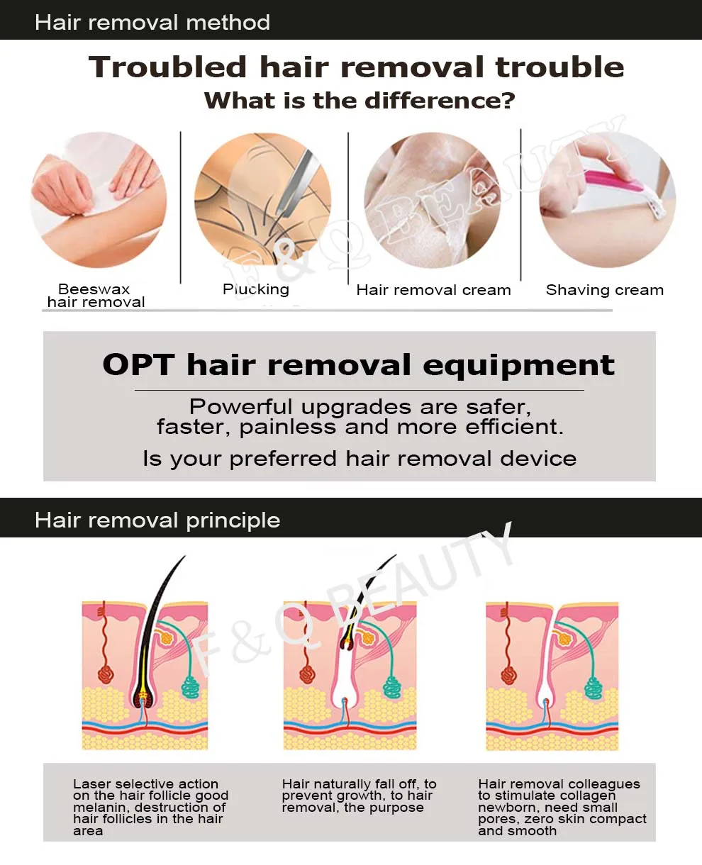 FQA20-7 Super IPL SHR hair removal/OPT  rejuvenation beauty equipment 