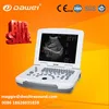 laptop ultrasound scanner & ultrasound dawei