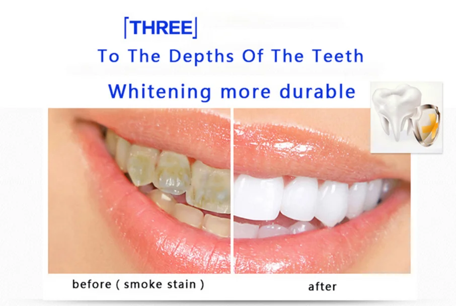 teeth-whitening-strips-6-hp-non-peroxide-private-logo-teeth-bleaching