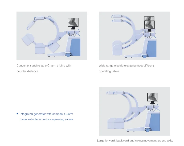 PLX118F Mobile Digital FPD C-arm System