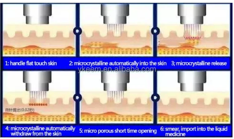 co2 fractional laser cost.jpg