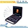 MSLCU11 2016 portable ultrasound system medical equipment 4d ultrasound scanner cheap color doppler ultrasound