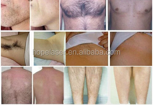 Before and after picture.jpg