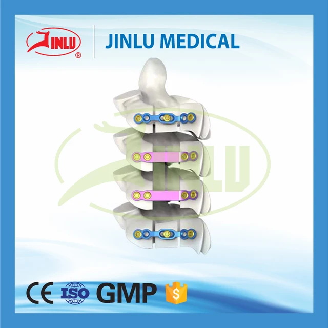 24 hours feedback medical tools hospital consumable titanium cervical plate from implants &