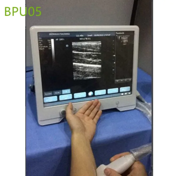 Touch Screen Portable Ultrasound Machines , Portable ultrasound machines , Portable ultrasound machine price , used Portable ultrasound machine , best laptop ultrasound machine , Portable ultrasound factory sell directly , price from medical ultrasound , medical scan machines ,ultrasound echo machine , ultrasound scanner , pregnancy test ultrasound machines , portable ultrasound scanner , mindry ultrasound scanner , cheapest usg , low price ultrasound scanner