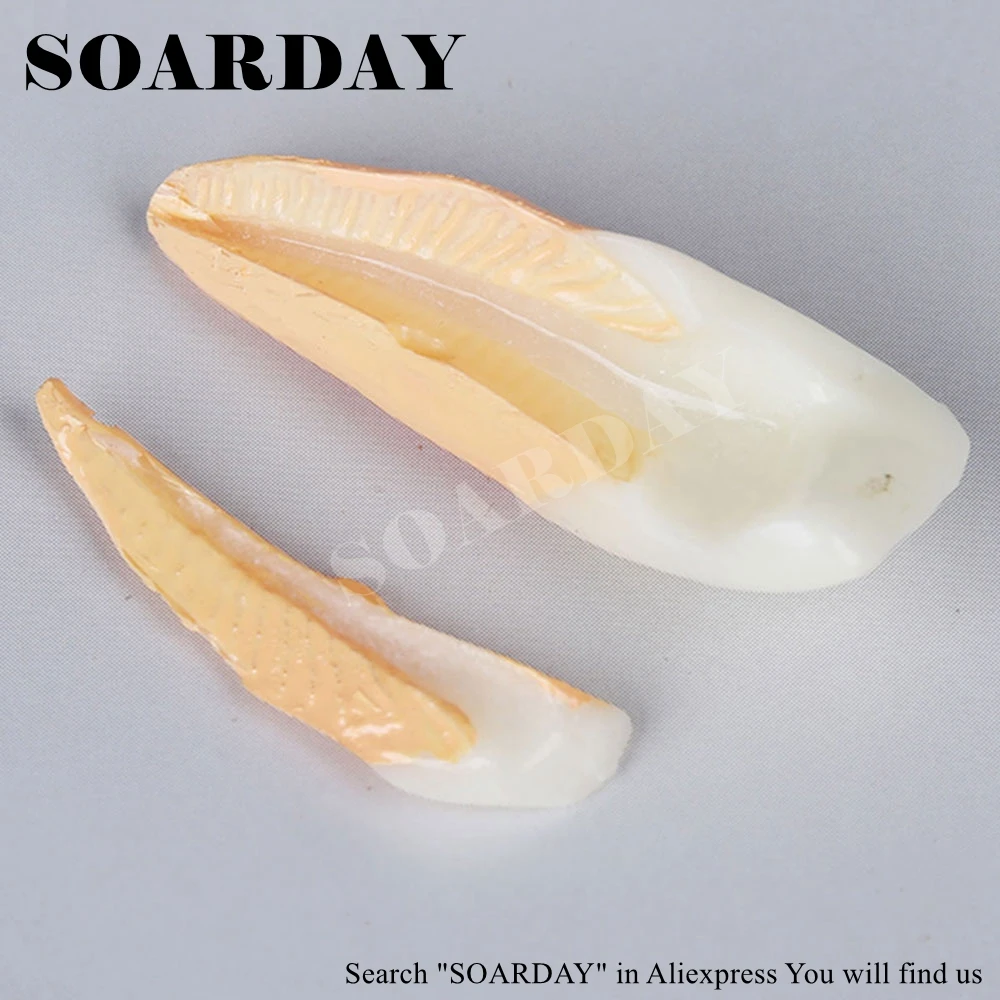 Endodontic Restoration Model (1)