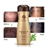 Organic Hair Growth Pilatory Bulk Shampoo Best Anti Hair Loss Treatment Product Providers From USA