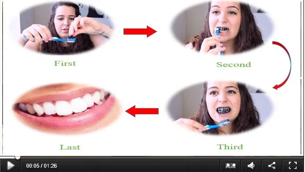 teeth whitening use 01.jpg