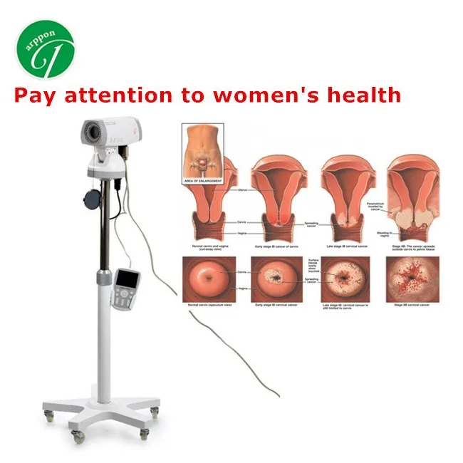 Vagina Video Colposcopy Colposcope For Gynecology Buy Vagina Video