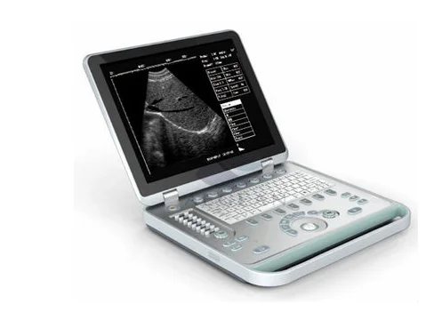 ultrasound machine for obstetric
