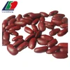 Importers of Red Speckled Kidney Bean, Different Types Of Kidney Beans, Types Of Edible Beans