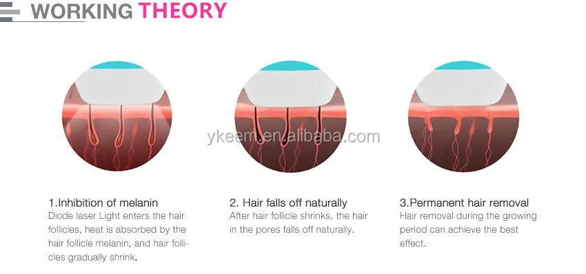 808nm diode laser hair removal machine.jpg