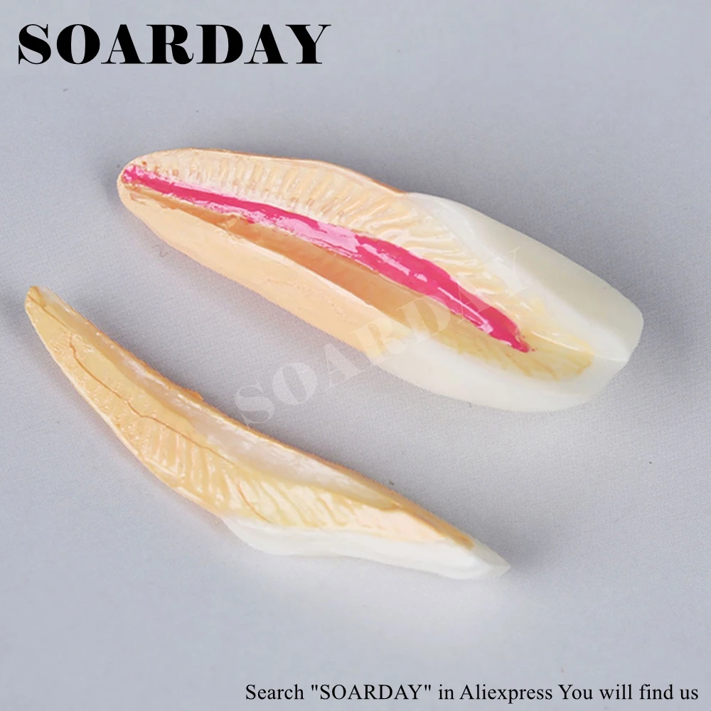 Endodontic Restoration Model (4)