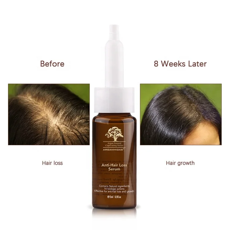 Best Prices Natural Organic Grow Hair Oil Hair Growth Formula Hair