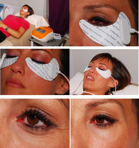 intelligent bonni eye care system treatment of eye bags and dark circle problems