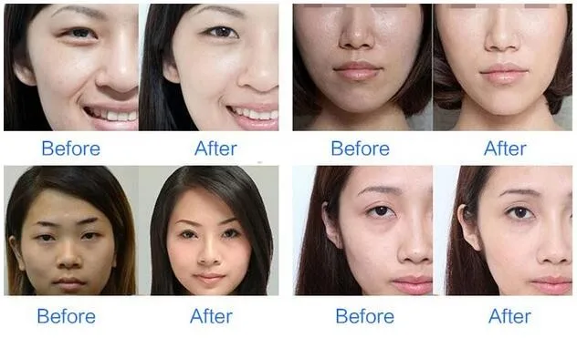 before and after.jpg