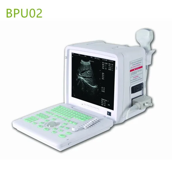 Portable ultrasound machines , Portable ultrasound machine price , used Portable ultrasound machine , best laptop ultrasound machine , Portable ultrasound factory sell directly , price from medical ultrasound , medical scan machines ,ultrasound echo machine , ultrasound scanner , pregnancy test ultrasound machines , portable ultrasound scanner , mindry ultrasound scanner , cheapest usg , low price ultrasound scanner