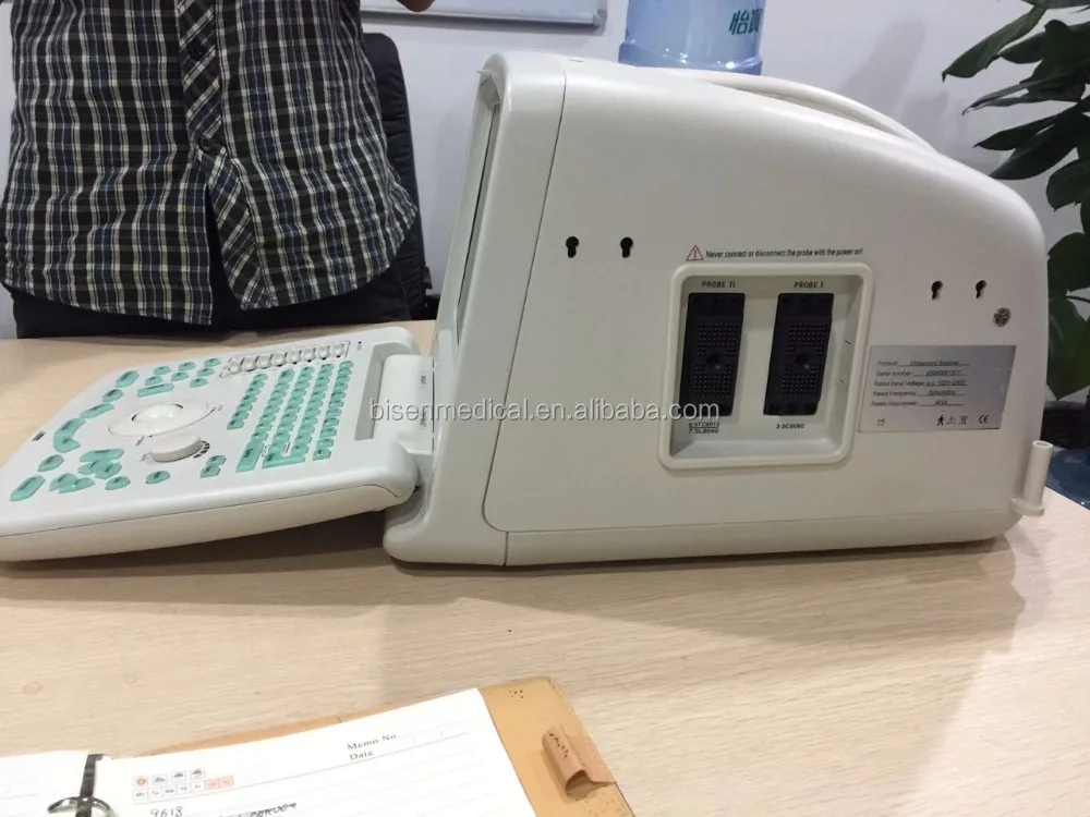 Cheap powerful function ultrasound scanner with convex array probe pretty and portable appearance