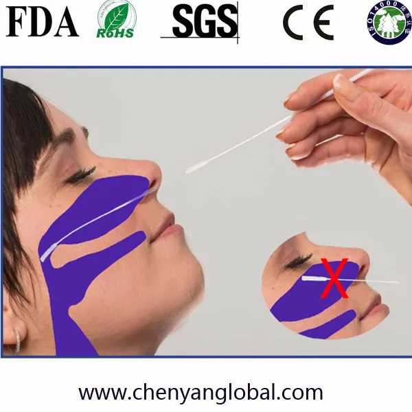 单灭菌包装诊断实验室一次性基因 dna 测试样品收集鼻咽尼龙植绒拭子