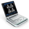 Best Price Clear MSLPU25 laptop Full digital ultrasound machine for pregnancy
