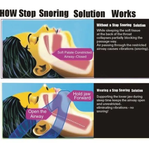 Adjustable Anti Snoring Chin Strap Jaw Sleep Aid Belt Snore Apnea FIX Support