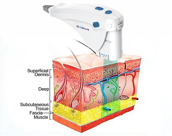 beauty ultrasound prostate cancer with CE certificate