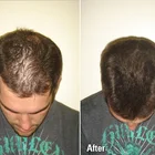 JIANYUAN Keratin Hair Bulding Fibers Hair Loss Treatment