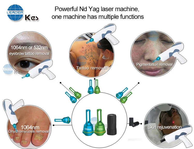 nd yag q-switch laser spot removal/q switched nd yag laser tattoo removal machine 2020/picosecond laser handle tattoo removal ma