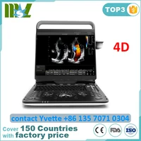 Chison EBit60 Laptop 4D Ultrasound Scanner