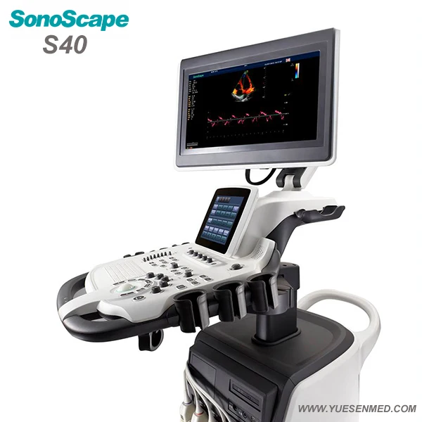3d 4d移动手推车彩色多普勒s40超声sonoscape超声心动图扫描仪