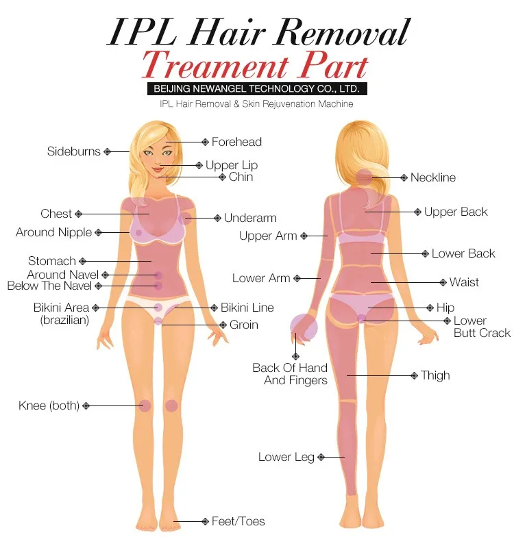 BM14-IPL_06.jpg