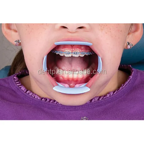 Cheek retractor.jpg