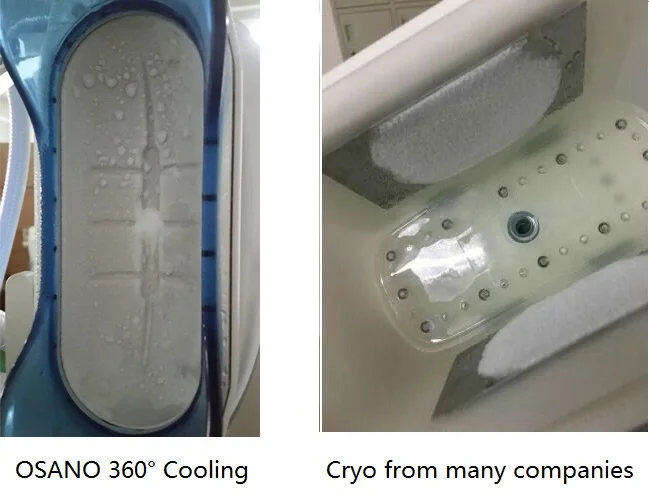 Double Chin Machine fat freeze Five Handles Freezing Fat Cryolipolyis Criolipolisis Machine