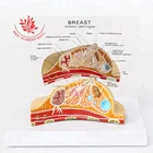Breast Cancer Cross Section Anatomical Model